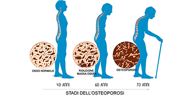osteoporosi4 tn