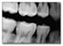dente1
