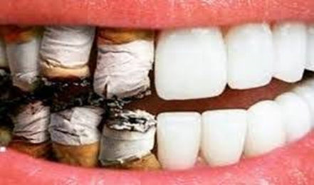 denti fumo