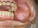 denti fumo2