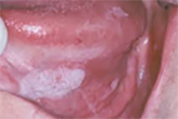 denti fumo3