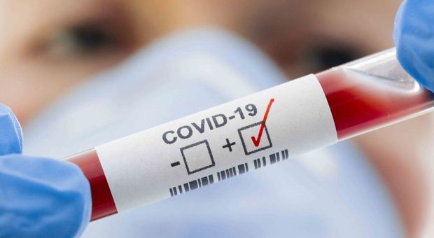 5255347 1943 test sangue coronavirus oggi ultime notizie mortalita